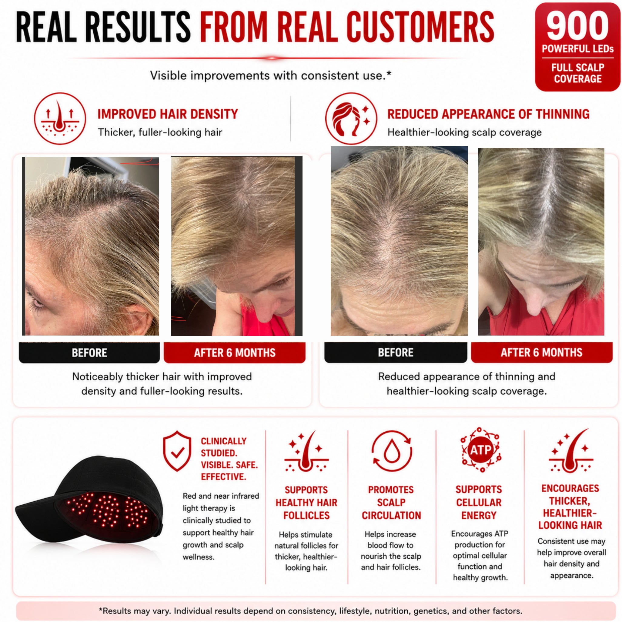Red Light Therapy Hat | 900 Powerful LEDs | Full Scalp Coverage | 5 Wavelengths | Includes 12V Car Adapter