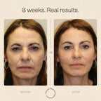 Nicebeam 9-in-1 Laser Light Therapy Lamp for Skin & Hair Rejuvenation